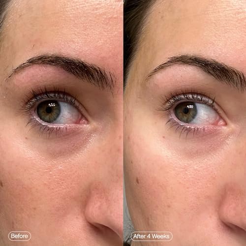 Faded Brightening Under Eye Masks, Depuffs & Brightens, Set of 6