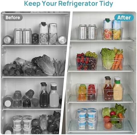 8pcs Clear Storage Bins with Handles