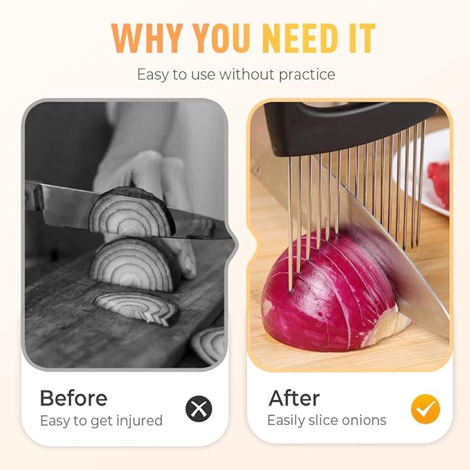 Onion Holder for Slicing, Stainless Steel Onion Slicer Holder, 2025 New Upgraded Tamato Slicer Vegetable Cutter Kitchen Gadeget Chopper Assistant Tool for Potato Lemon Fruit and Meat (1pc)